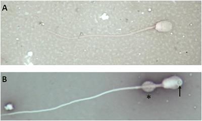 An Autosomal Translocation 73,XY,t(12;20)(q11;q11) in an Infertile Male Llama (Lama glama) With Teratozoospermia